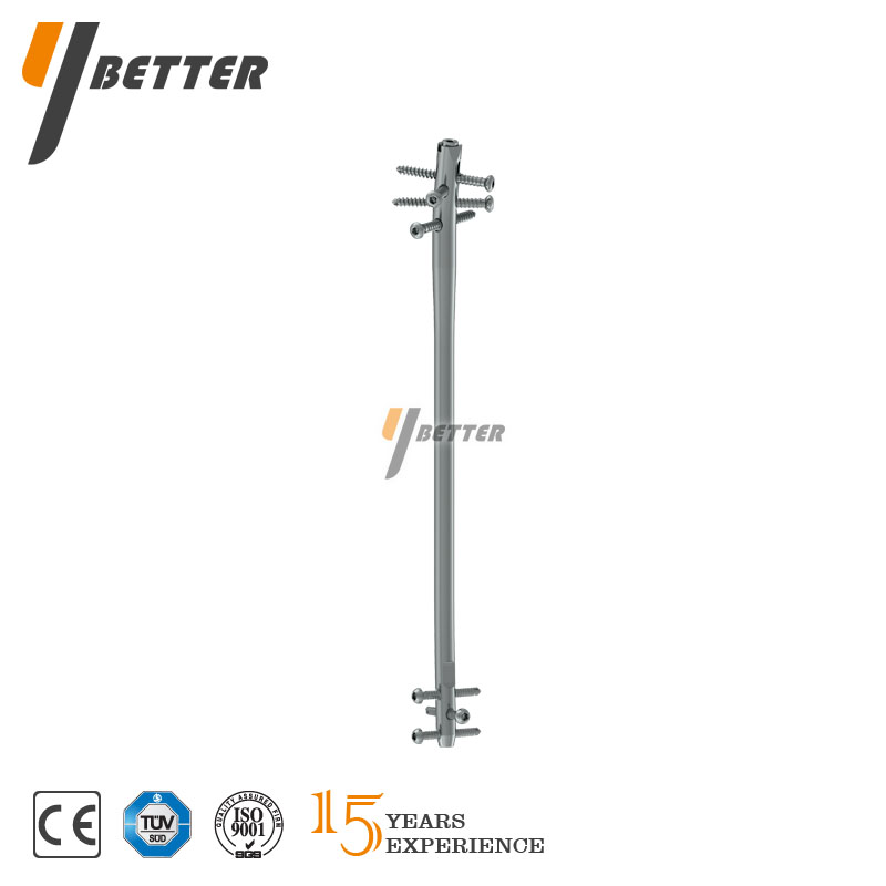 鎖定型脛骨髓內(nèi)釘