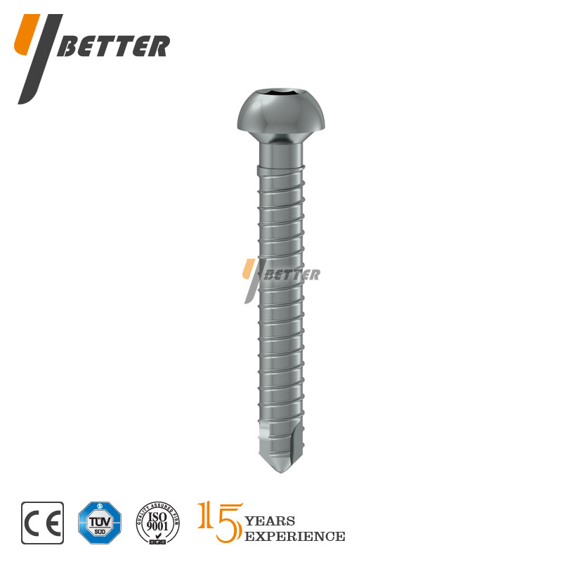 鎖定型脛骨髓內(nèi)釘 (遠端鎖釘）