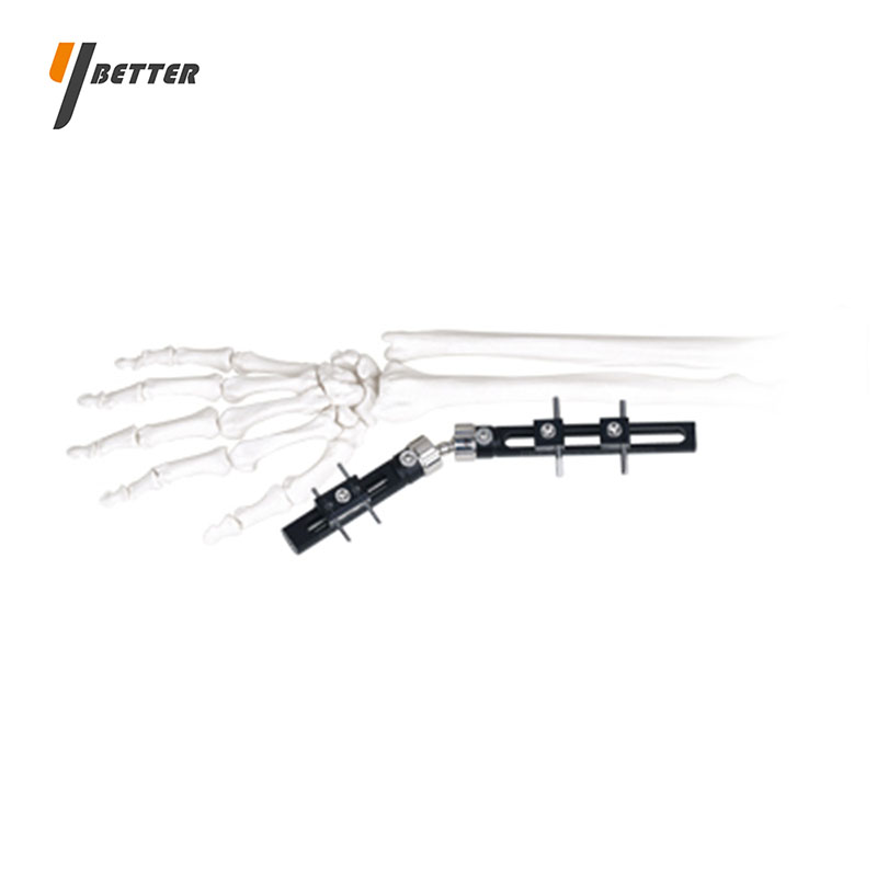 腕關(guān)節(jié)支架