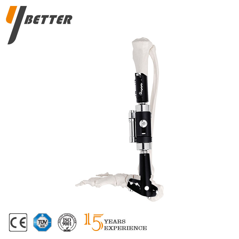 脛骨遠端骨折支架