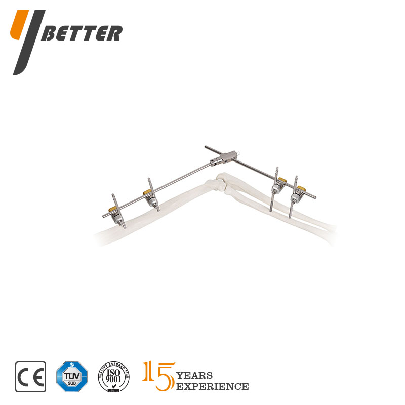 肘關(guān)節(jié)型